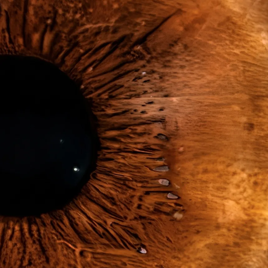 Fotografia macro di un’iride marrone realizzata nell’ambito di IRIS DAY di Ottica Dentella ad Ancona, con tonalità calde, fibre radiali e dettagli naturali dell’occhio messi in evidenza attraverso una ripresa ravvicinata. Il progetto IRIS DAY nasce per raccontare la straordinaria unicità dell’iride attraverso un’immagine artistica personalizzata, capace di trasformare i colori e le trame dell’occhio in una composizione visiva unica.