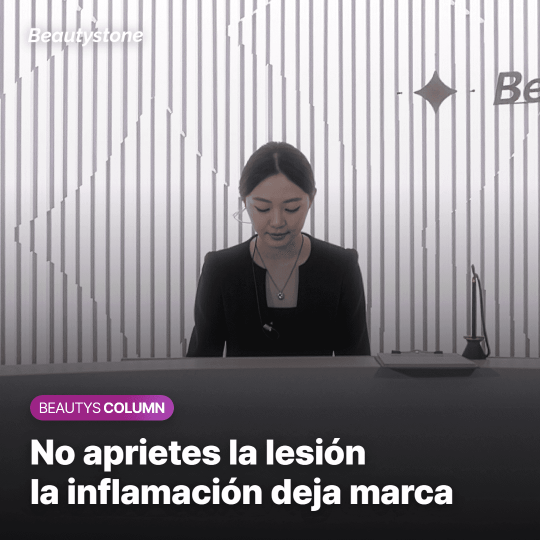 Mano que evita tocar una lesión de acné en la mejilla