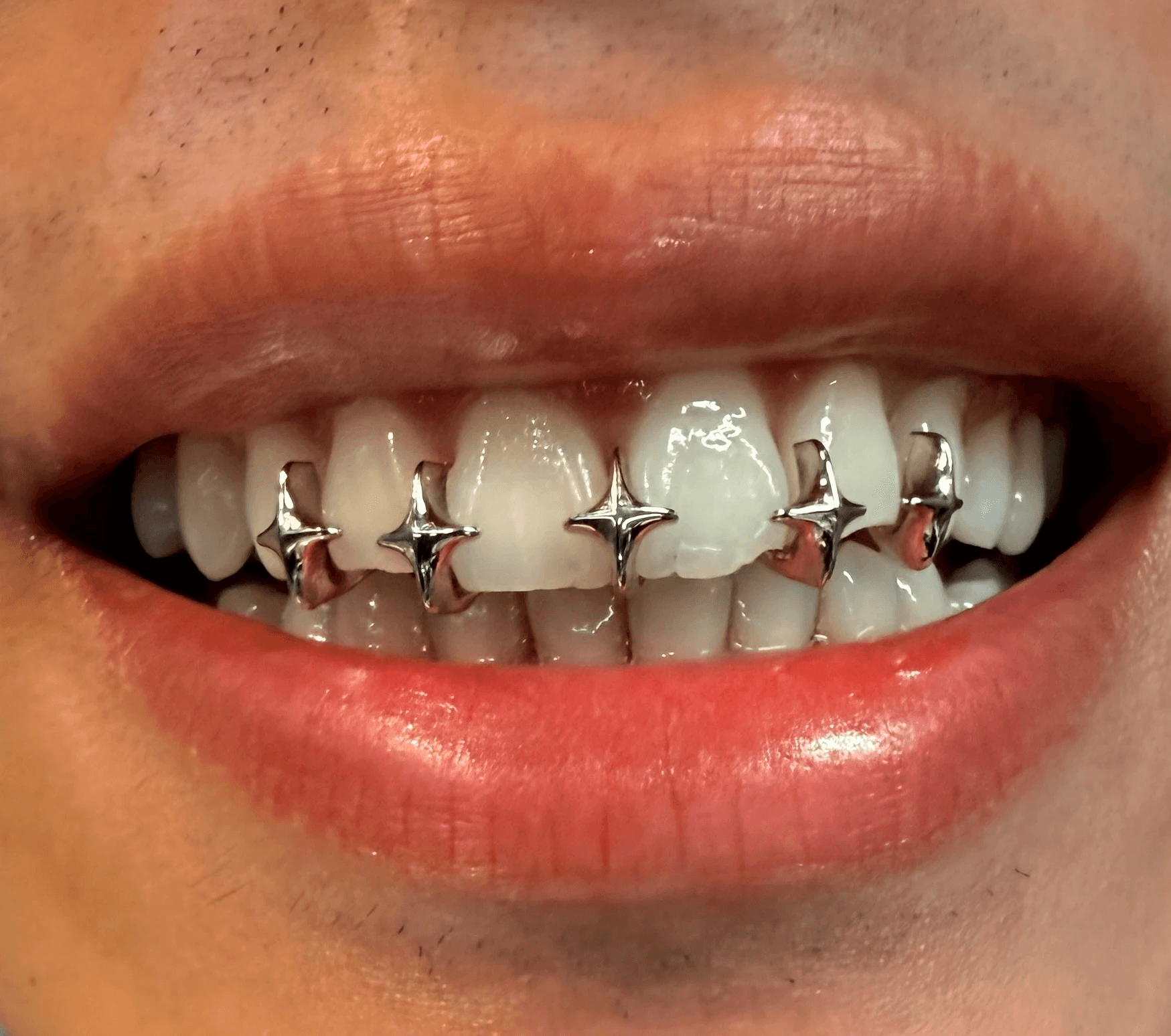 Star-Shaped Spacer Set