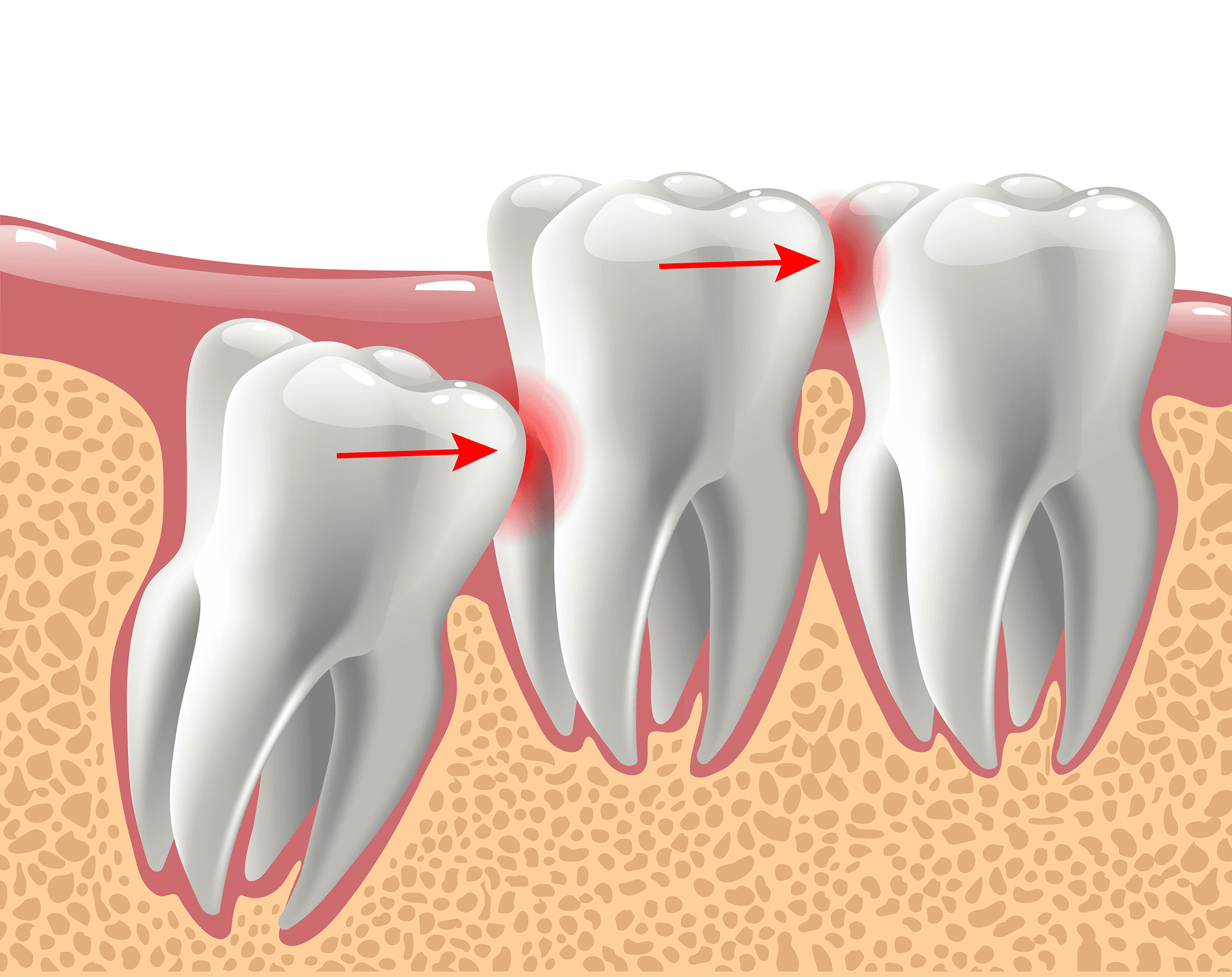 Dental professional examining patient’s teeth in modern clinic setting.