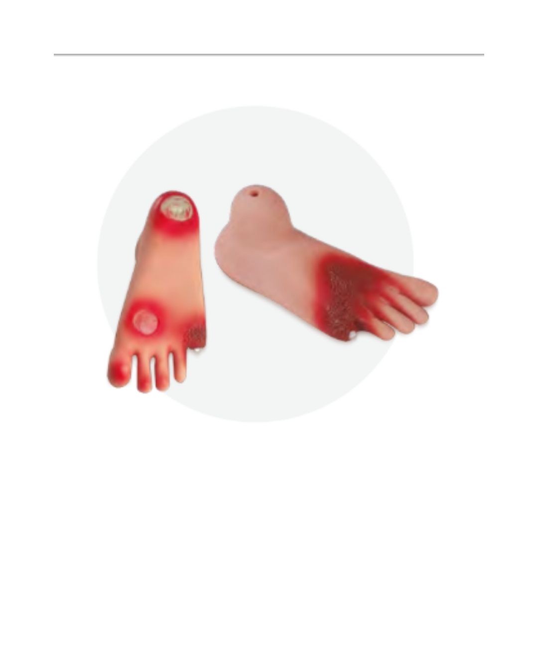 Diabetes Foot Model