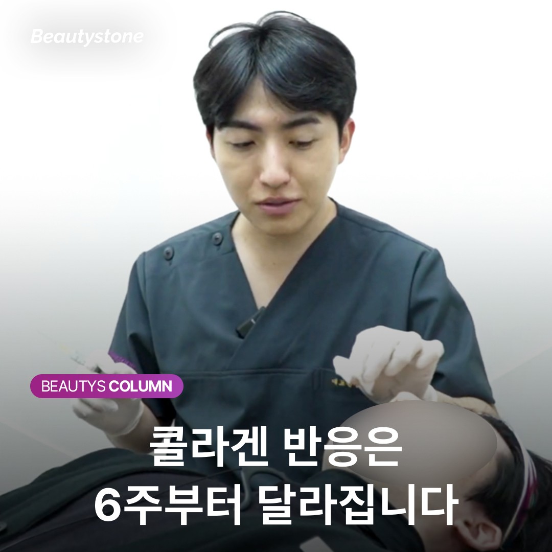 스컬트라와 쥬베룩, 이름은 비슷해도 결과가 다른 결정적 이유