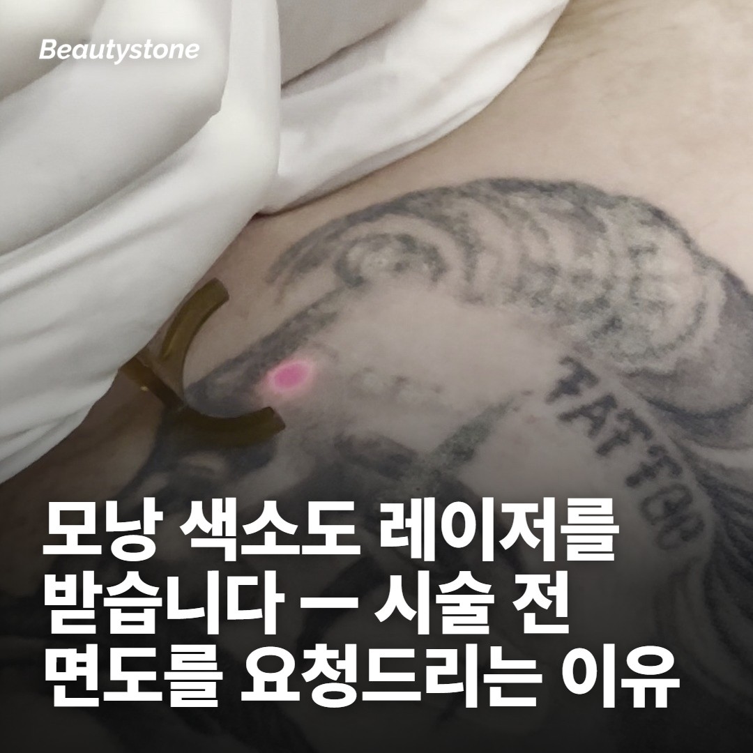 털이 있는 자리는 레이저가 두 가지를 동시에 봅니다