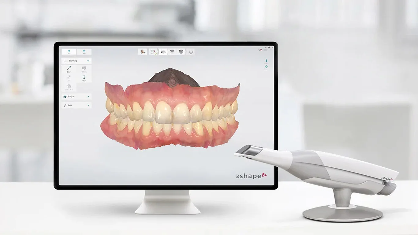 Intraoral scanner dental implants 香港香港