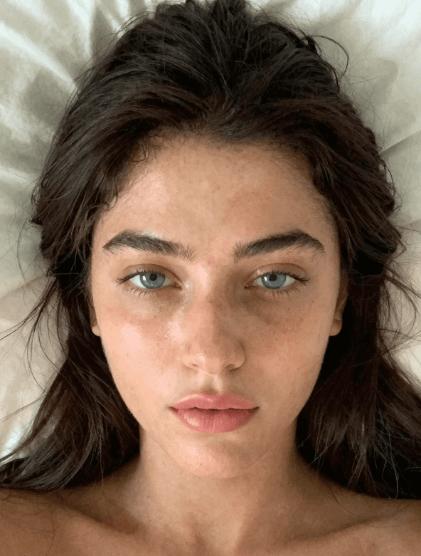 Lüma Skin - projects