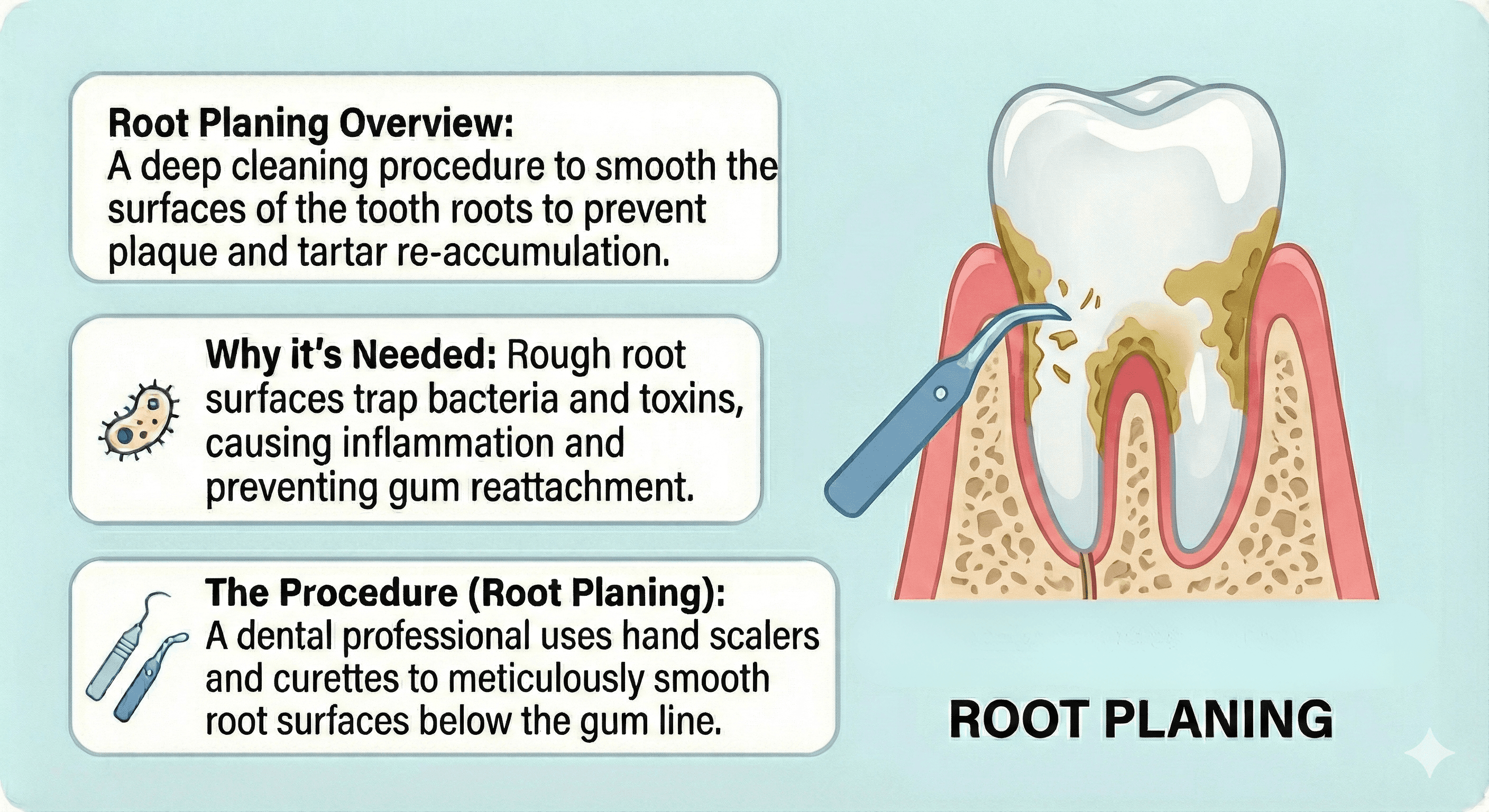 Infographic of root planing in North York, ON at Sovrle Dental Clinic describing an overview of the procedure, causes of swollen gums, and how the procedure is performed | Top rated dentist in North York, ON at Sovrle Dental Clinic