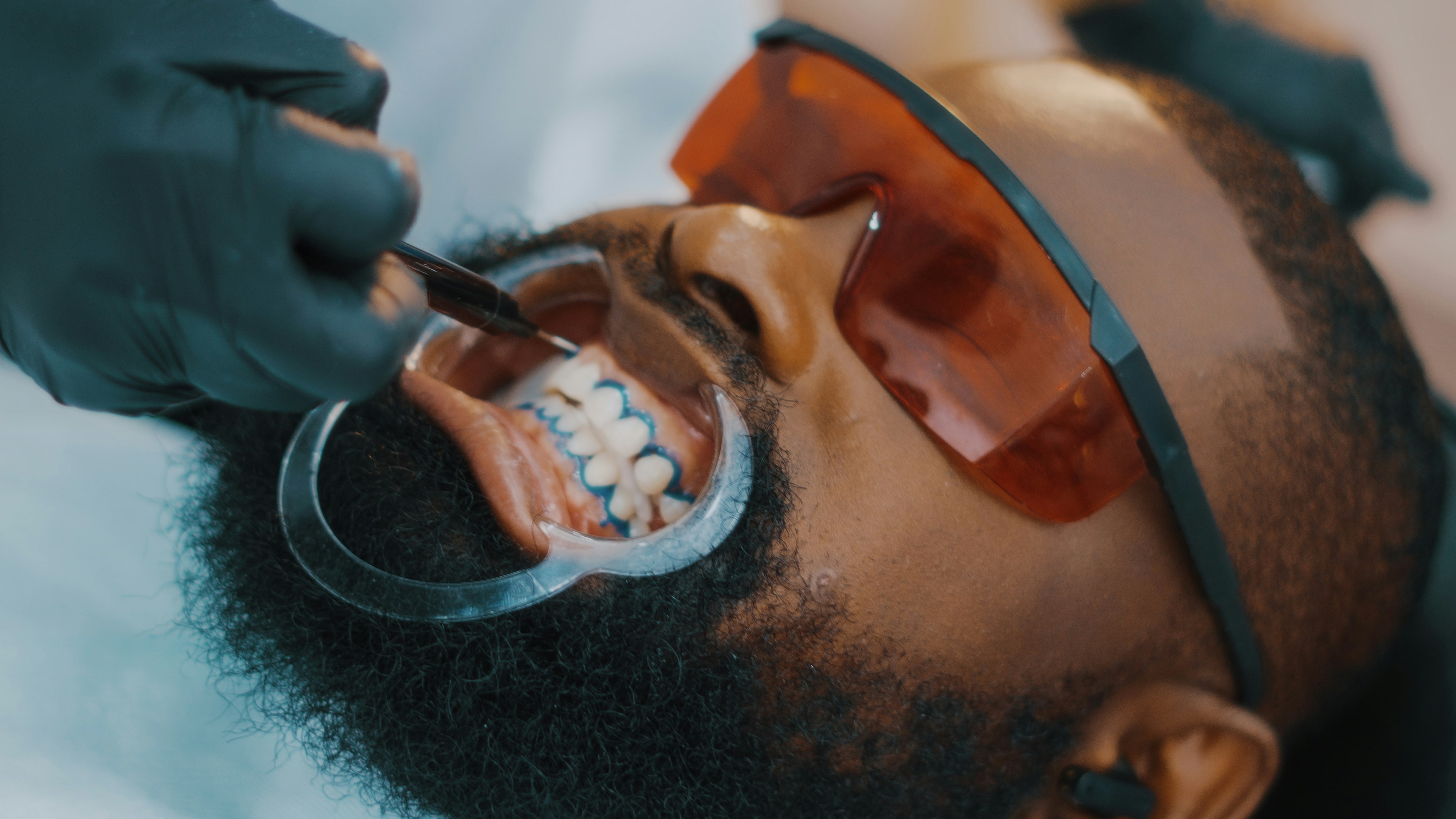 Teeth Whitening Rochelle Park