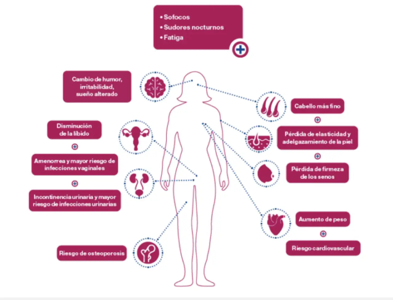 Infografía síntomas de la menopausia
