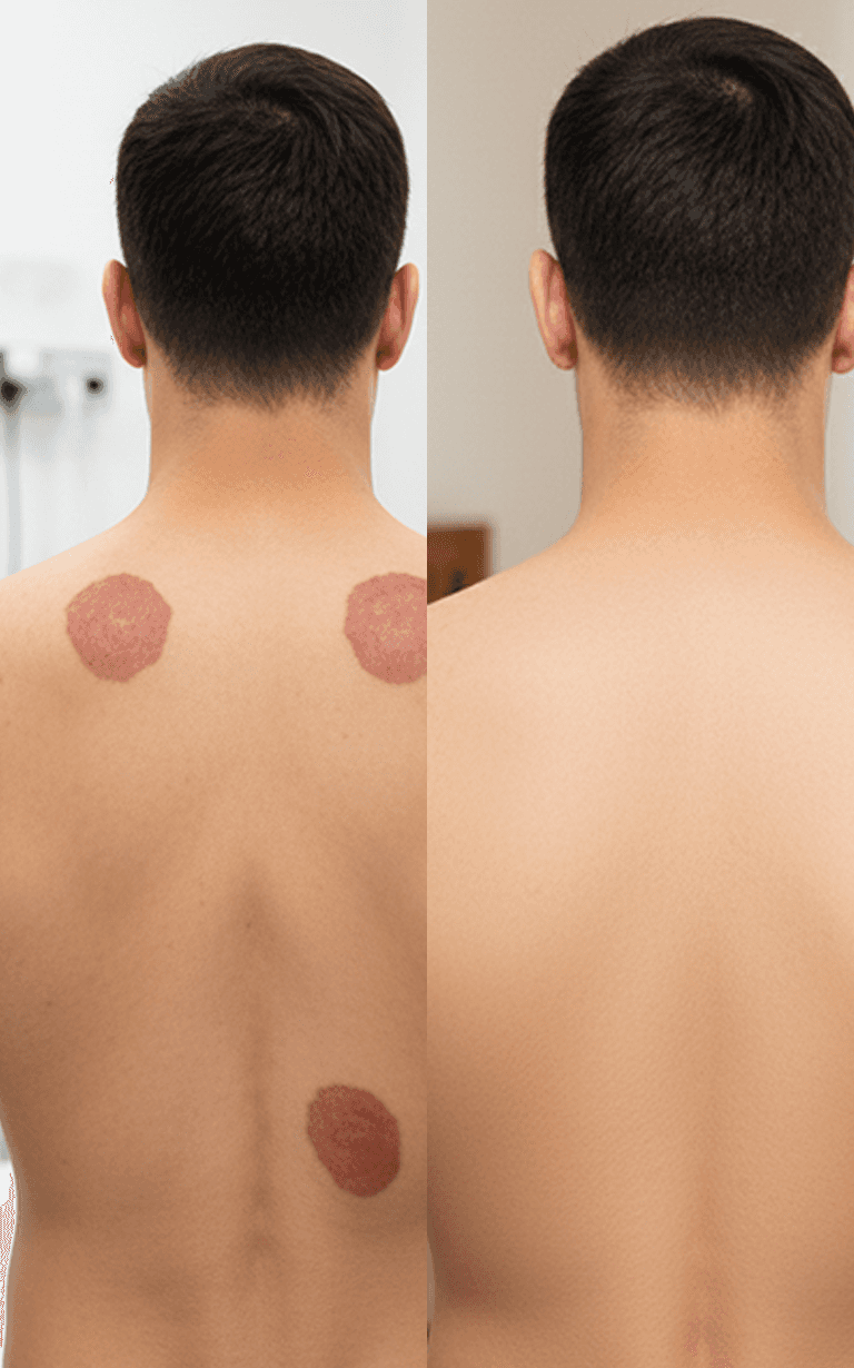 Before and after treatment - face close-up