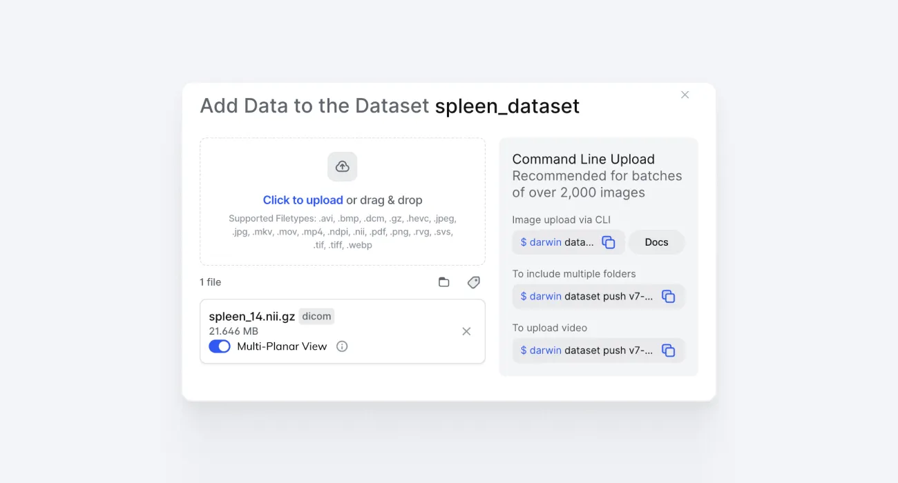 adding data to a dataset in v7