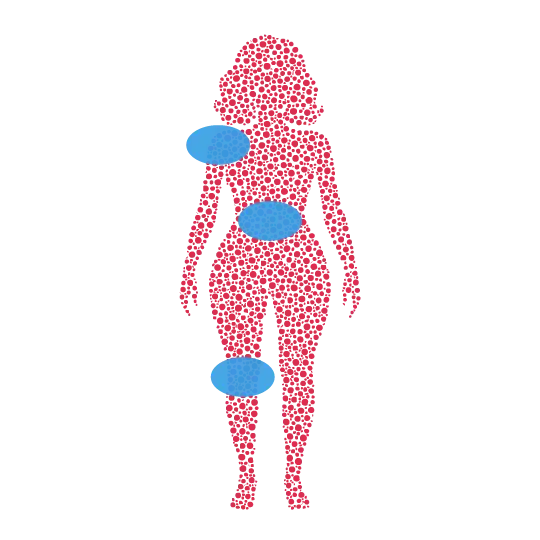 KPV peptide therapy target areas body map – Event Hydration