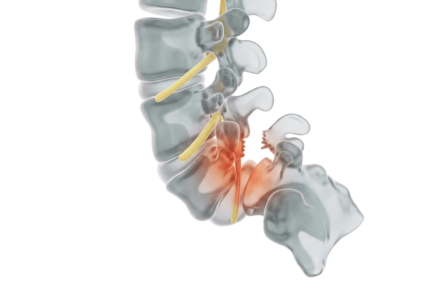 Adult ACL Injury