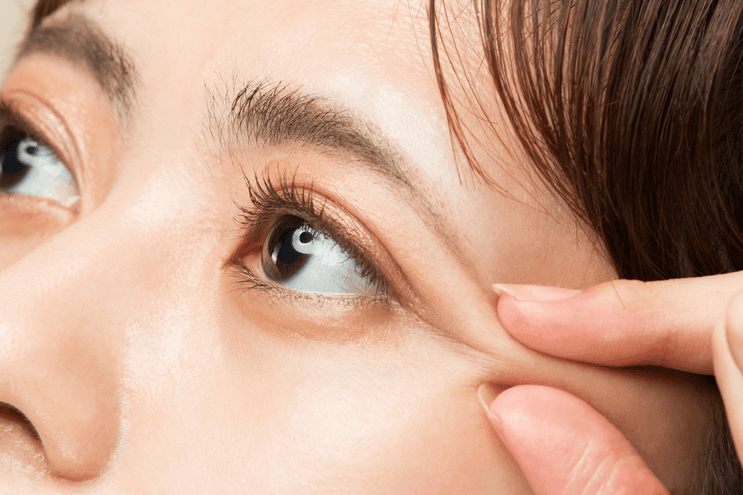 Không chà xát hay dụi mắt dễ khiến chỉ bị bung