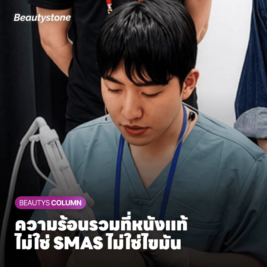 การ์ดอธิบายว่าความร้อนของ Sofwave รวมตัวที่ชั้นหนังแท้ระดับกลาง
