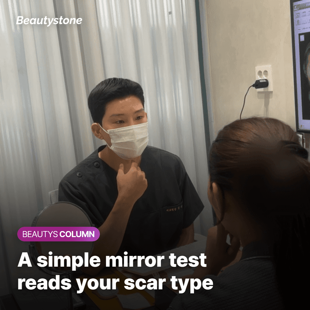 Using a mirror to check which acne scar shape you have