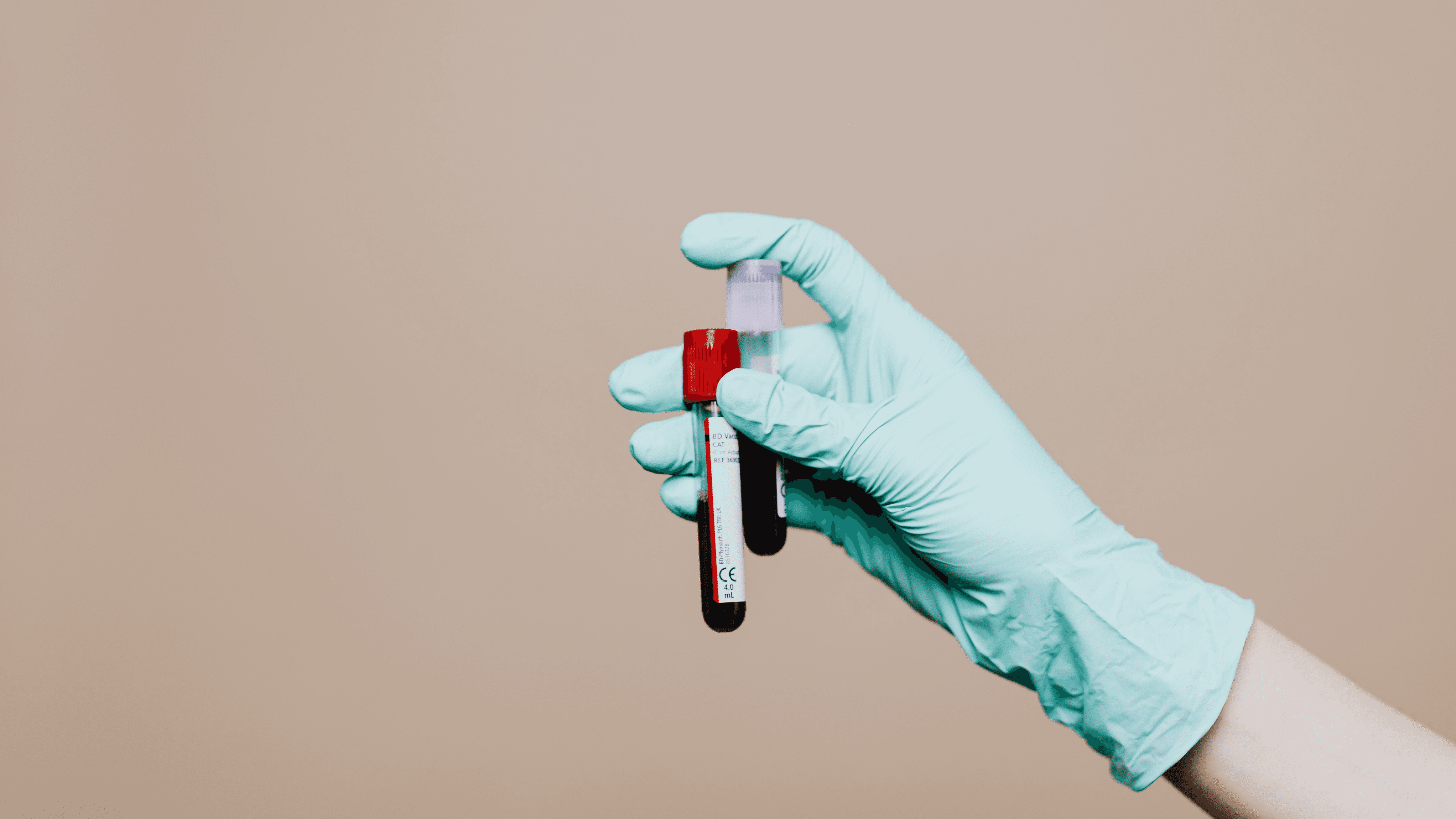 Blood test results explanation on Joumal of health for Health Research content