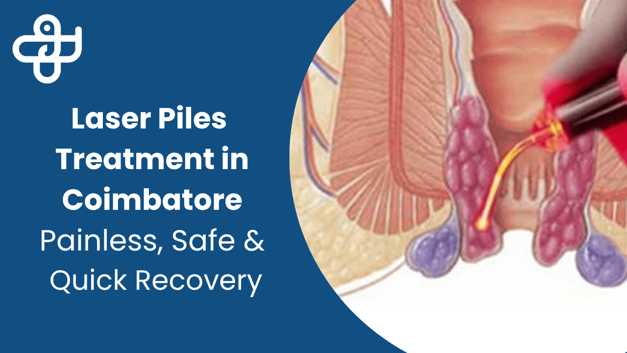 Laser Piles Treatment