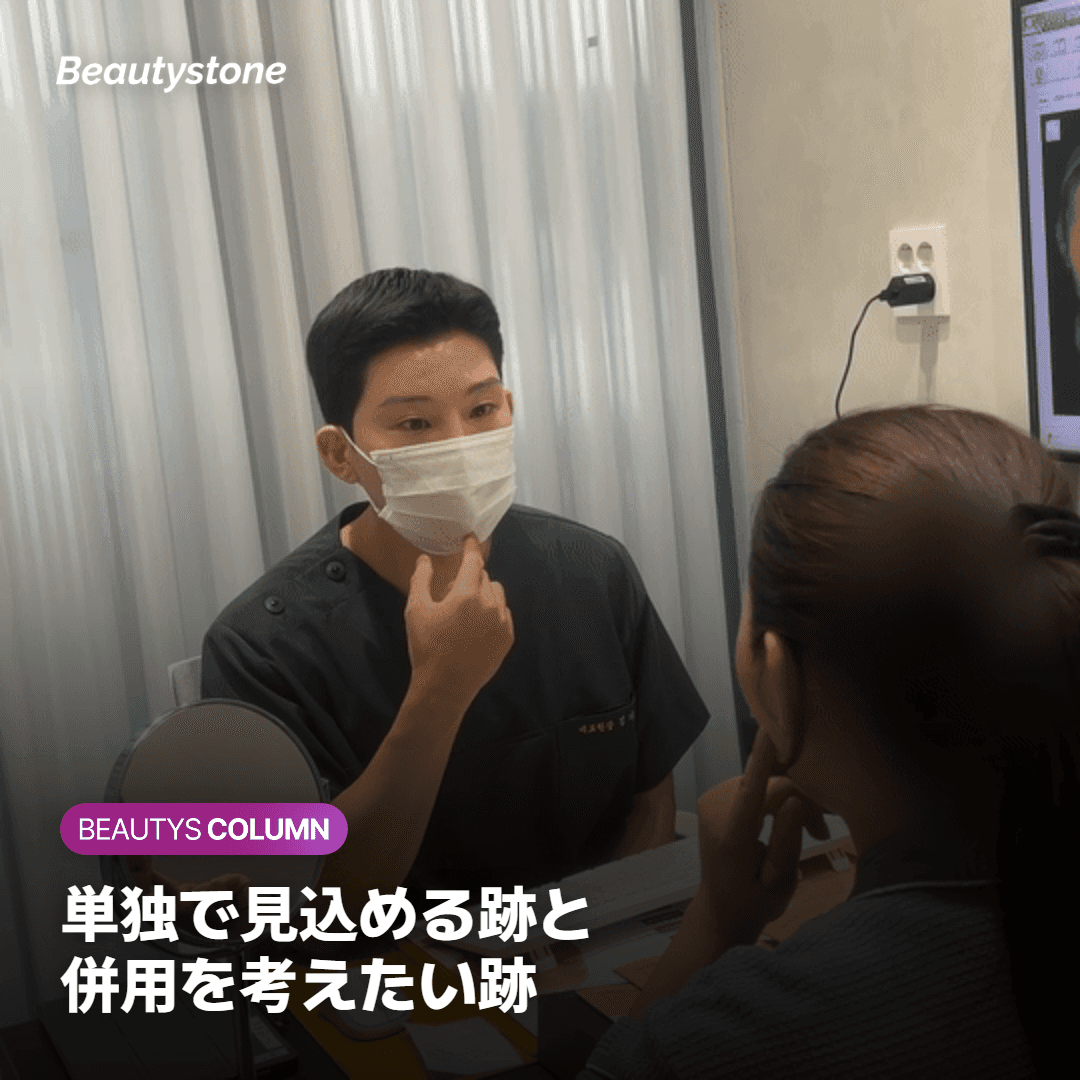 シークレットRF単独で見込める跡と併用を検討したい跡を比べる図