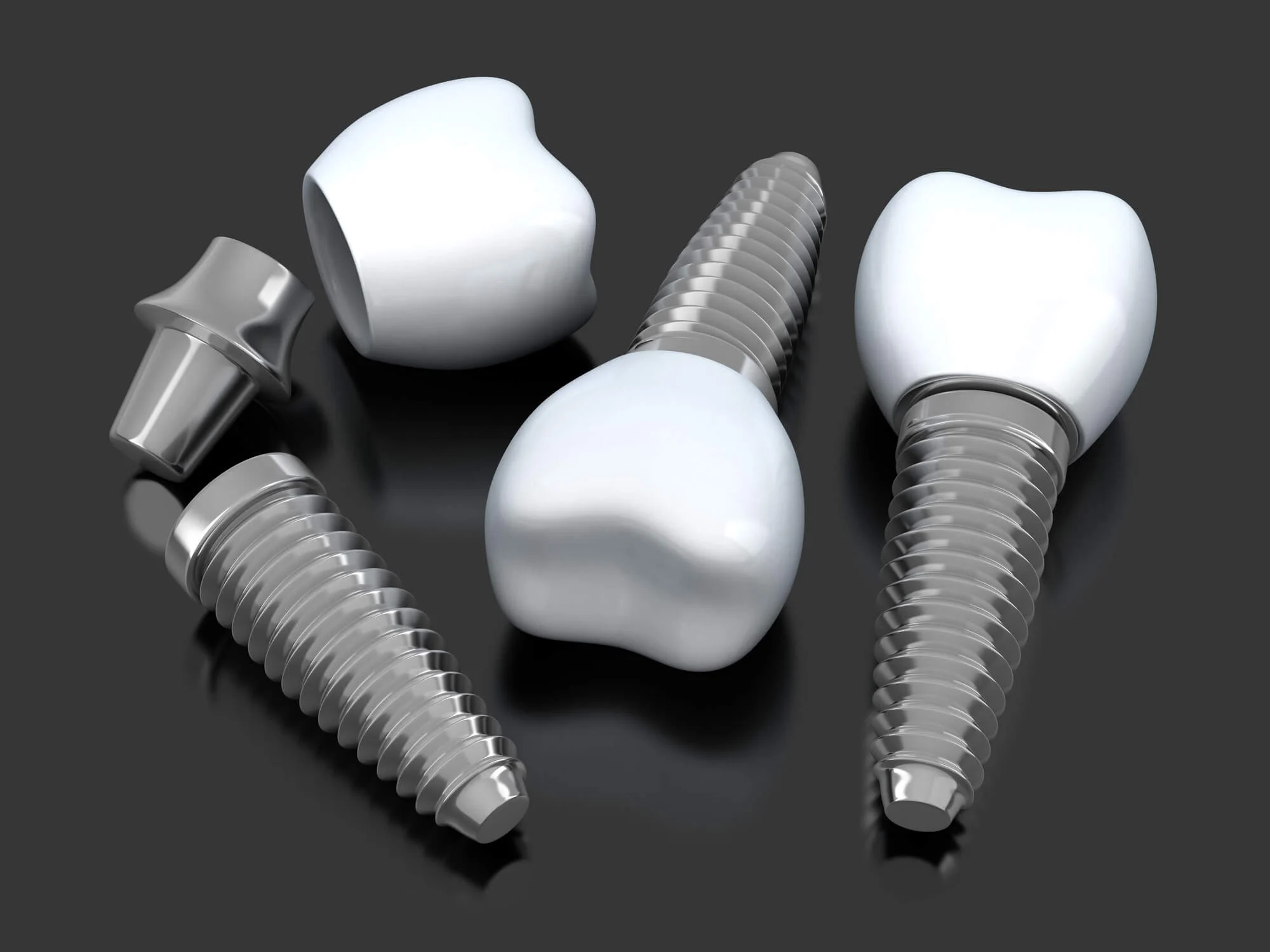 dental implants