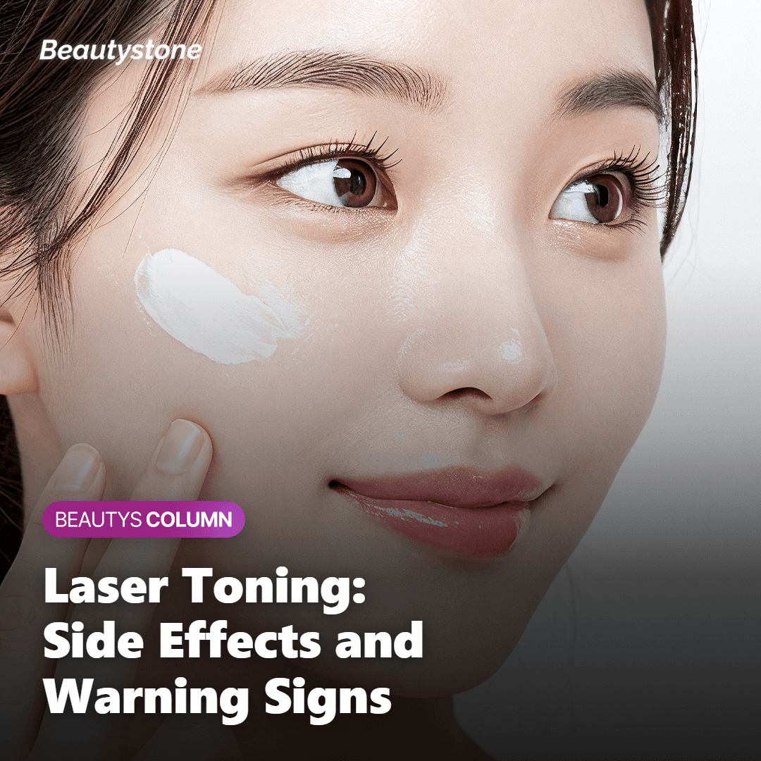 Melanocytes producing extra melanin causing temporary darkening after laser toning