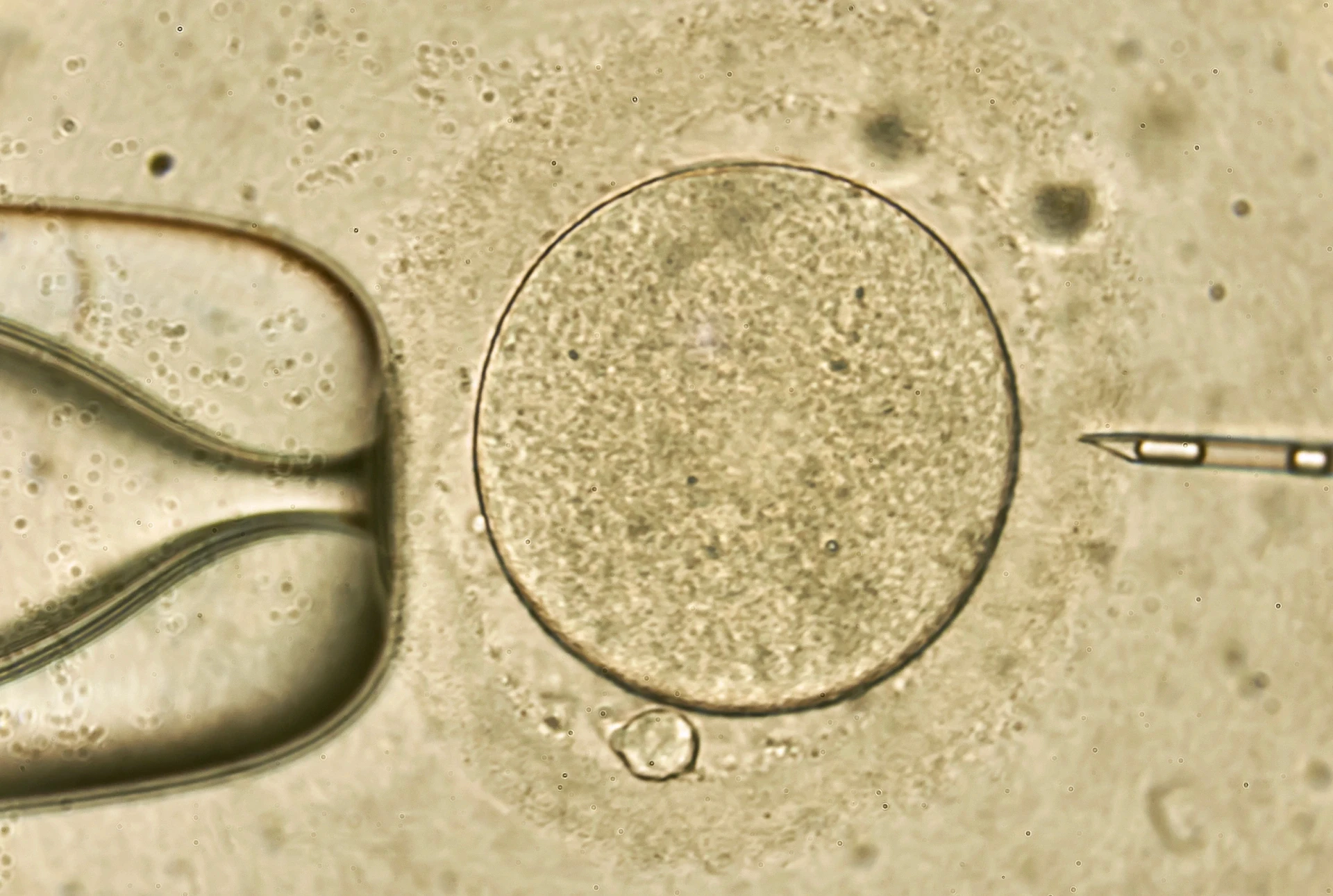 Fertilização do óvulo na reprodução assistida