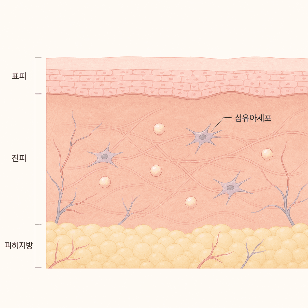 입자가 남은 자리에서 콜라겐이 만들어지는 과정