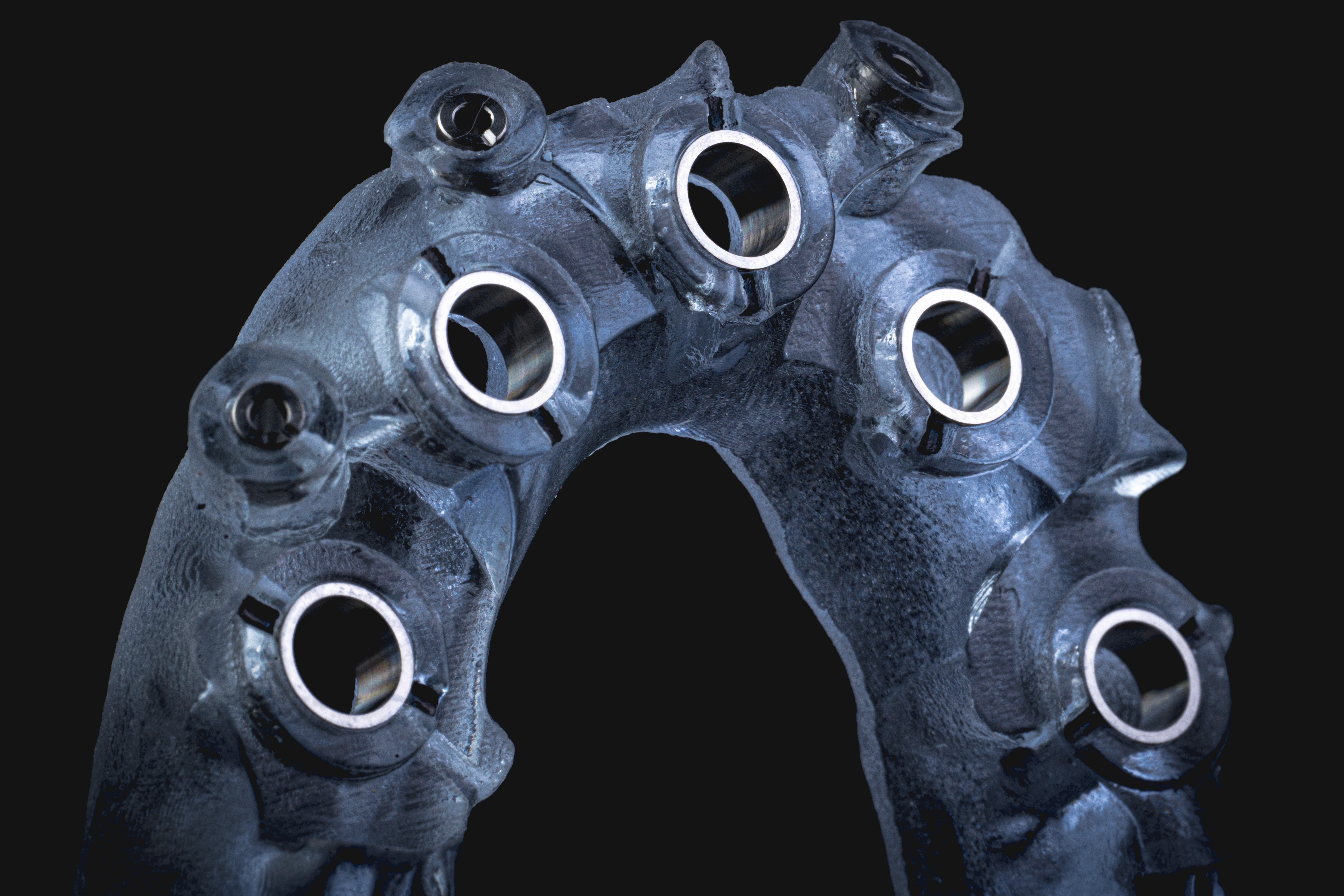 Digital Treatment Planning