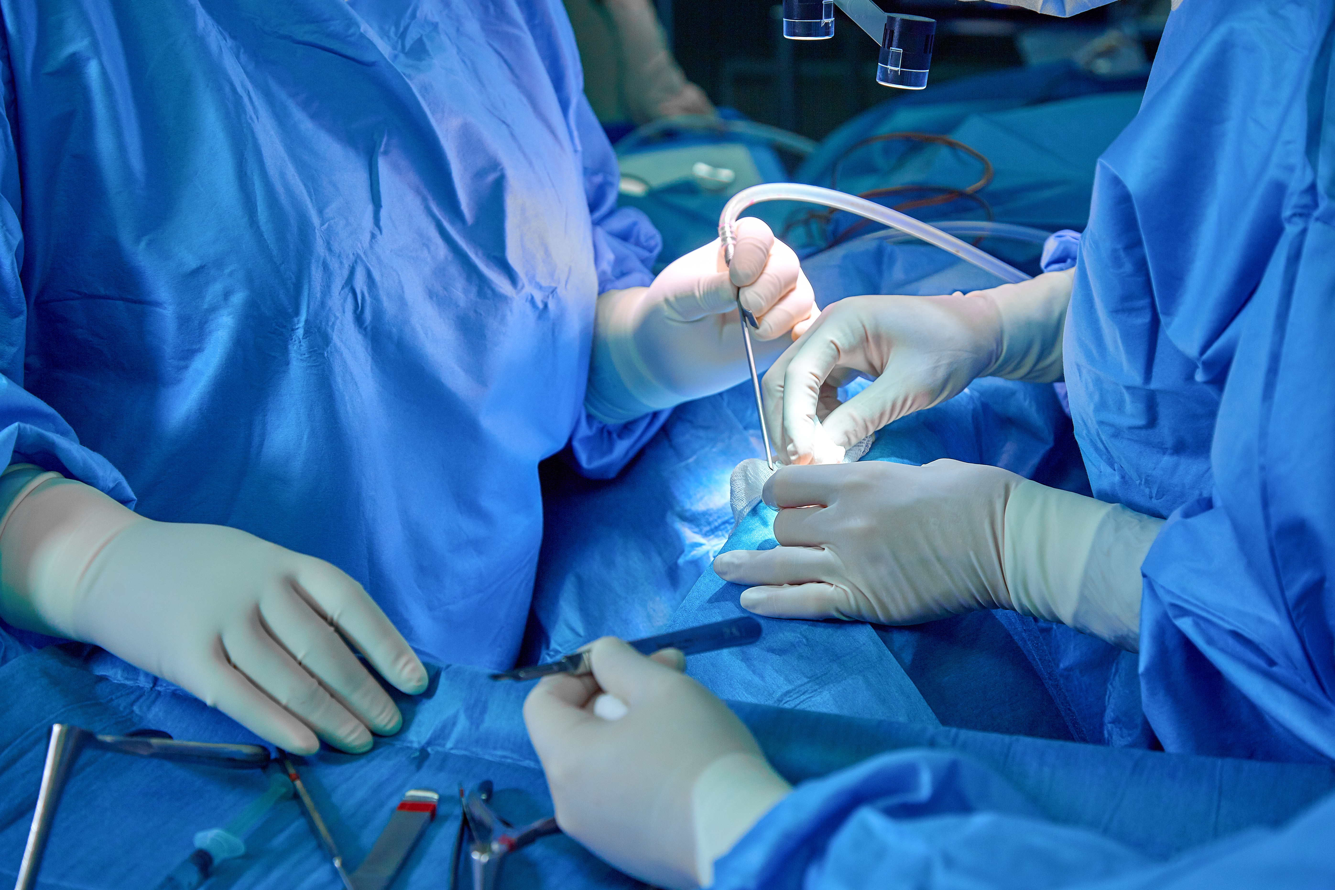 Minimally invasive MitraClip procedure for treating mitral regurgitation