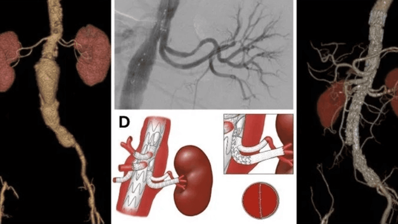 Check-up vascular Dr. Gustavo Paludetto