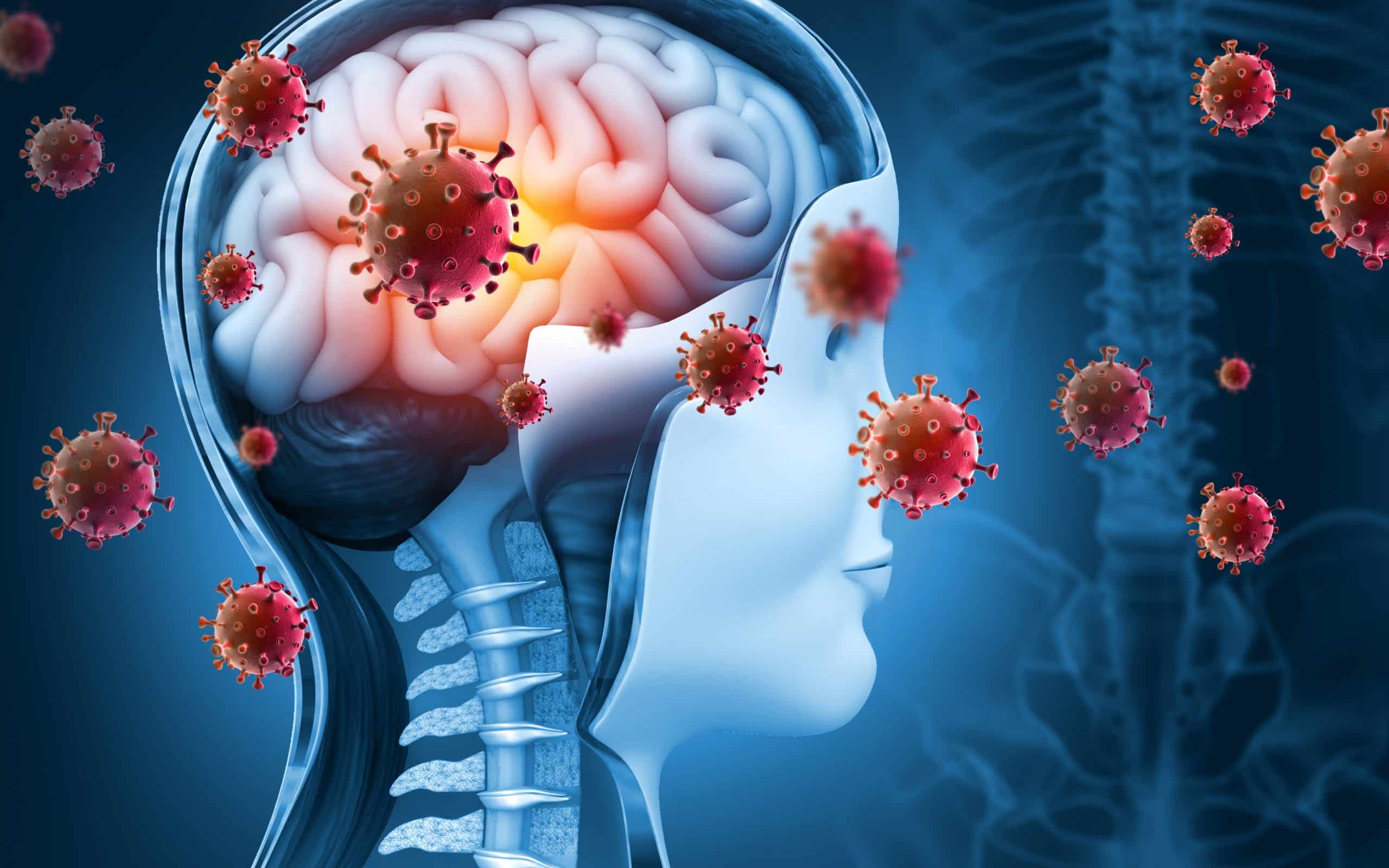 Meningitis Virus affecting the brain