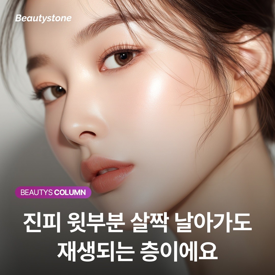 "분명 다 빠졌다고 했는데..." 흑자가 한두 달 만에 똑같은 자리에 생기는 원인