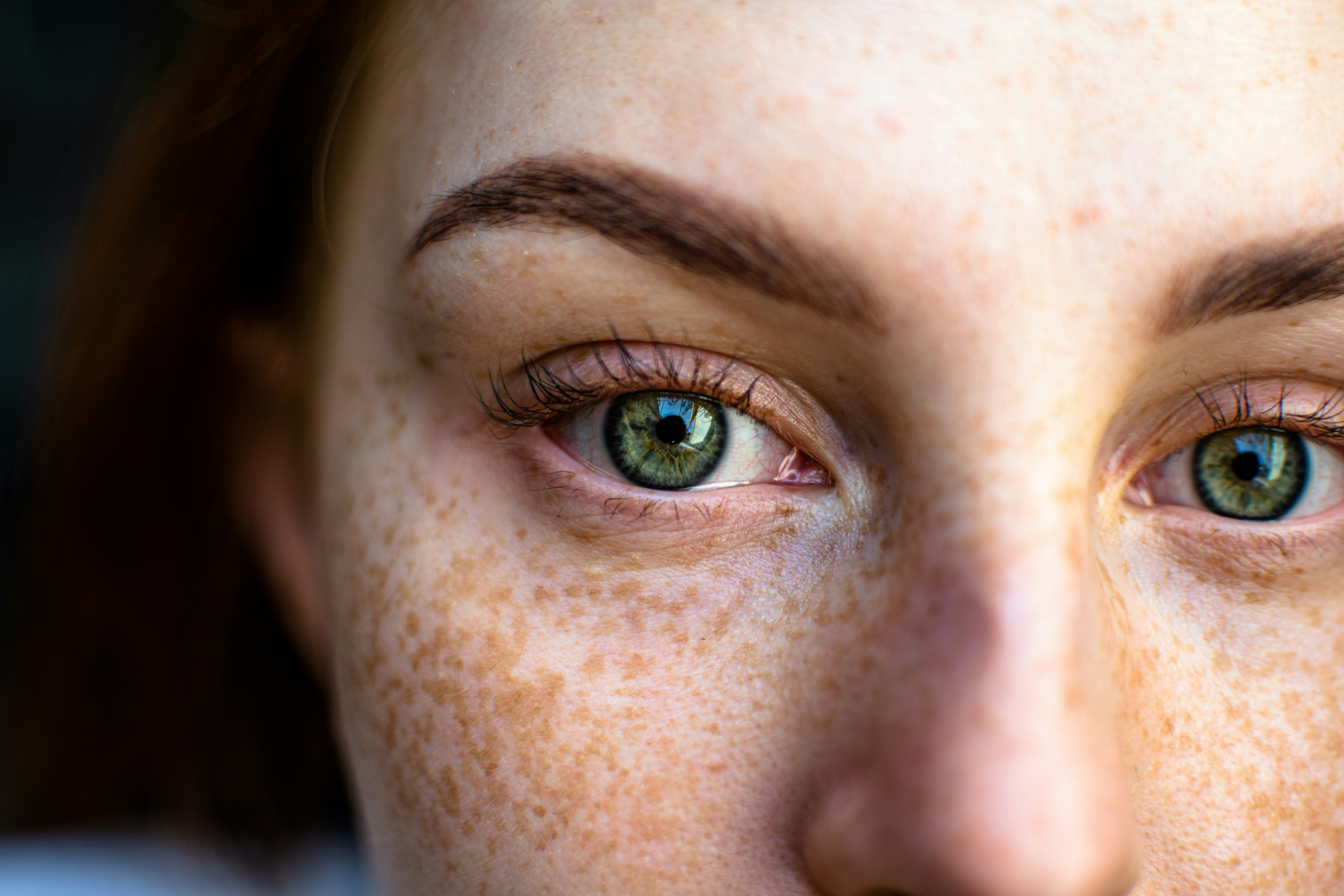 woman with freckles looking for Skincare For Combination Skin