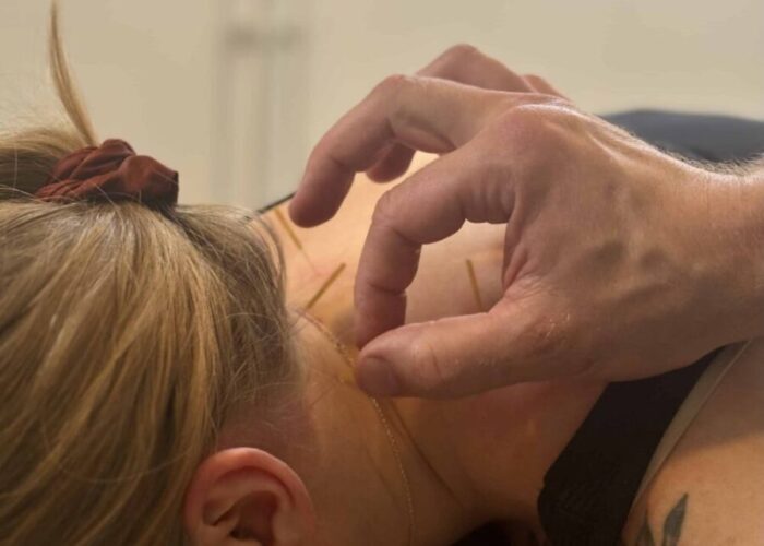 The Ultimate Guide to Teeth Whitening