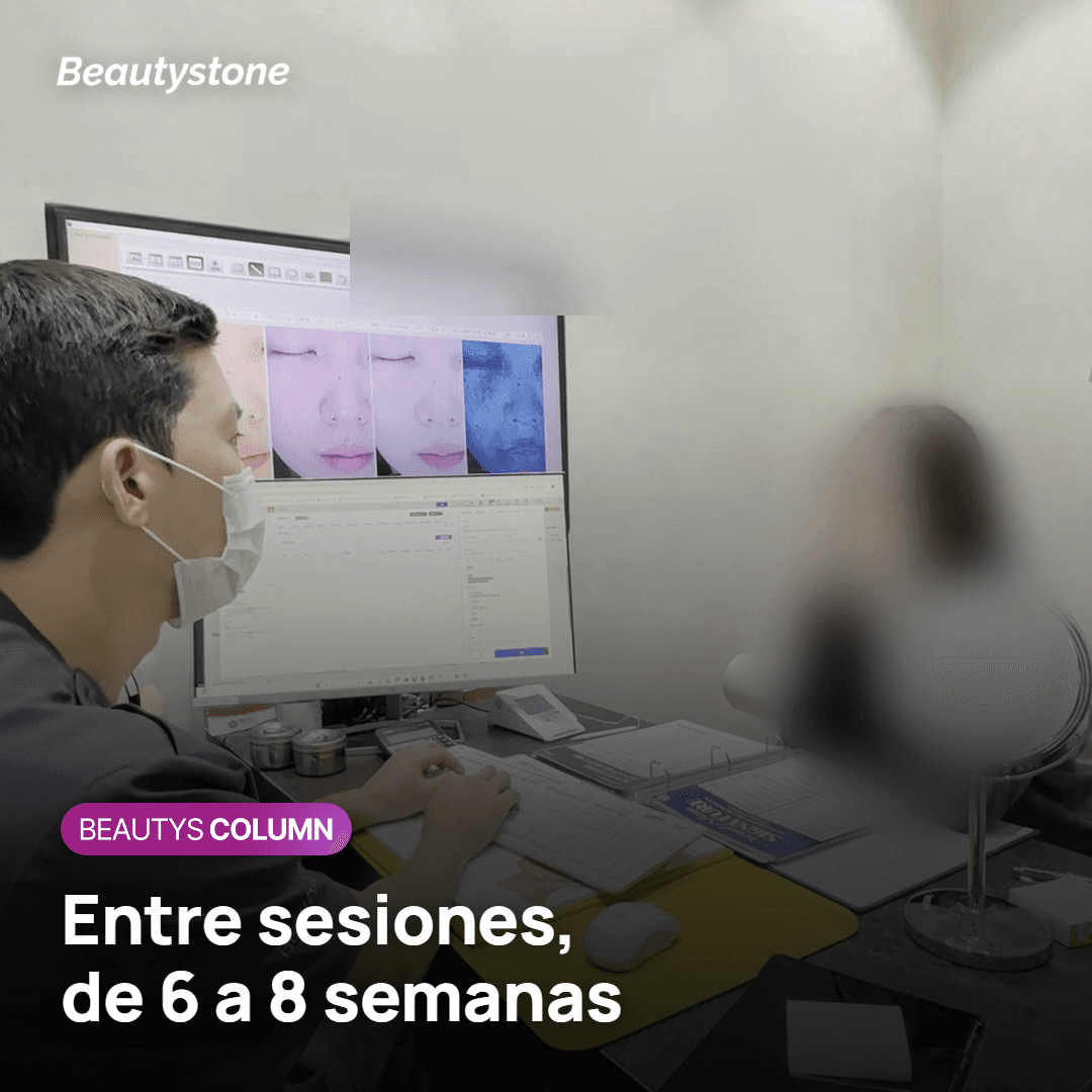Sesiones de eliminación de tatuaje separadas de 6 a 8 semanas