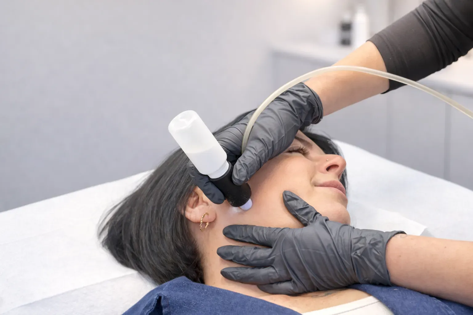 Client receiving a Microdermabrasion facial treatment using a professional device in a clinical setting