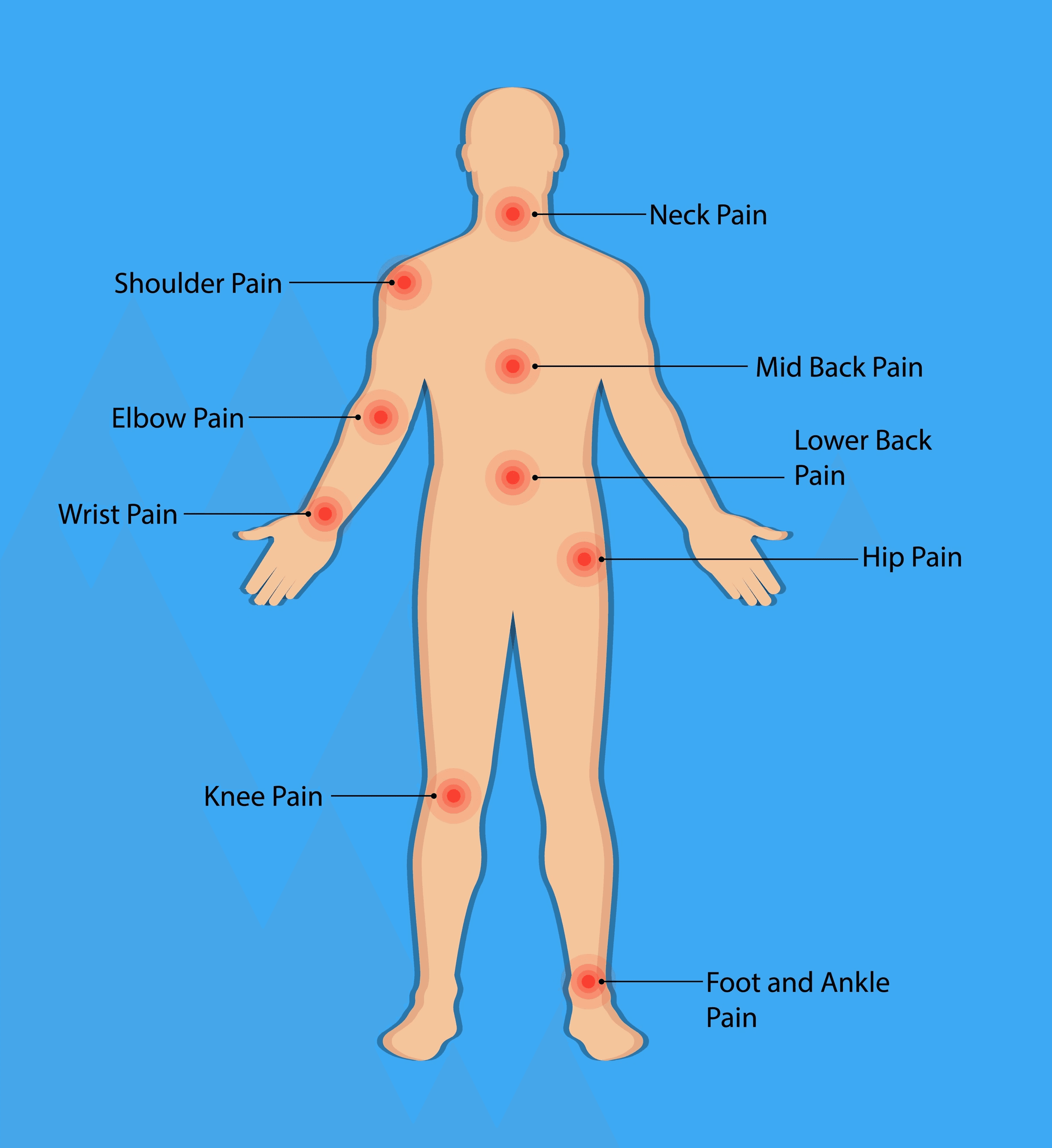 pain indication chart shockwave therapy