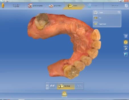 Computer-Guided Digital Smile Design | Bloor-Yorkville Periodontics