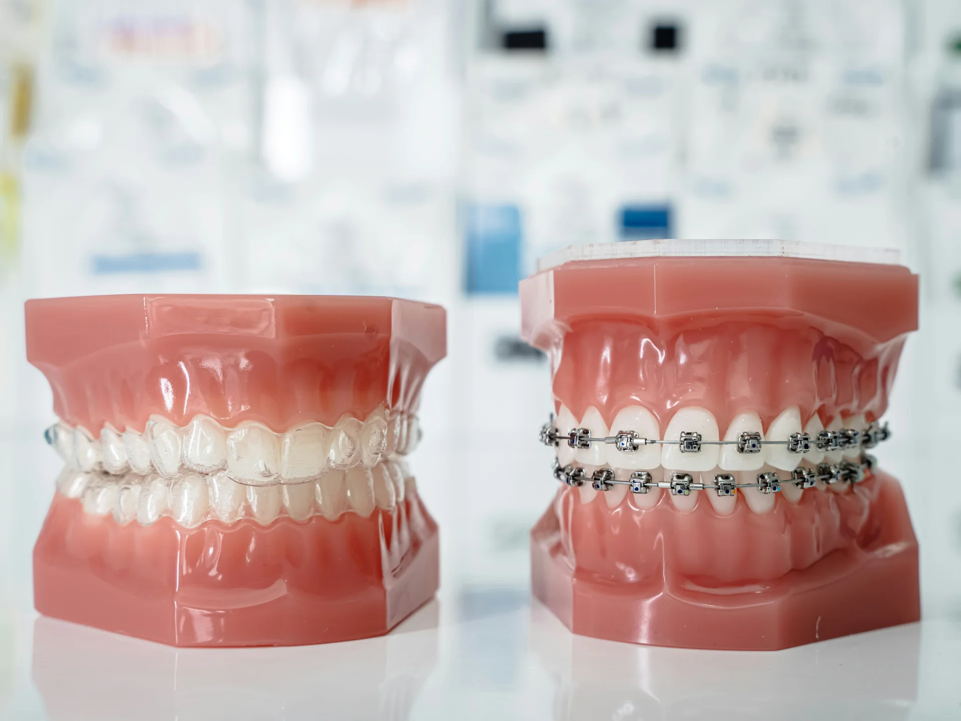 Orthodontics & Braces service image