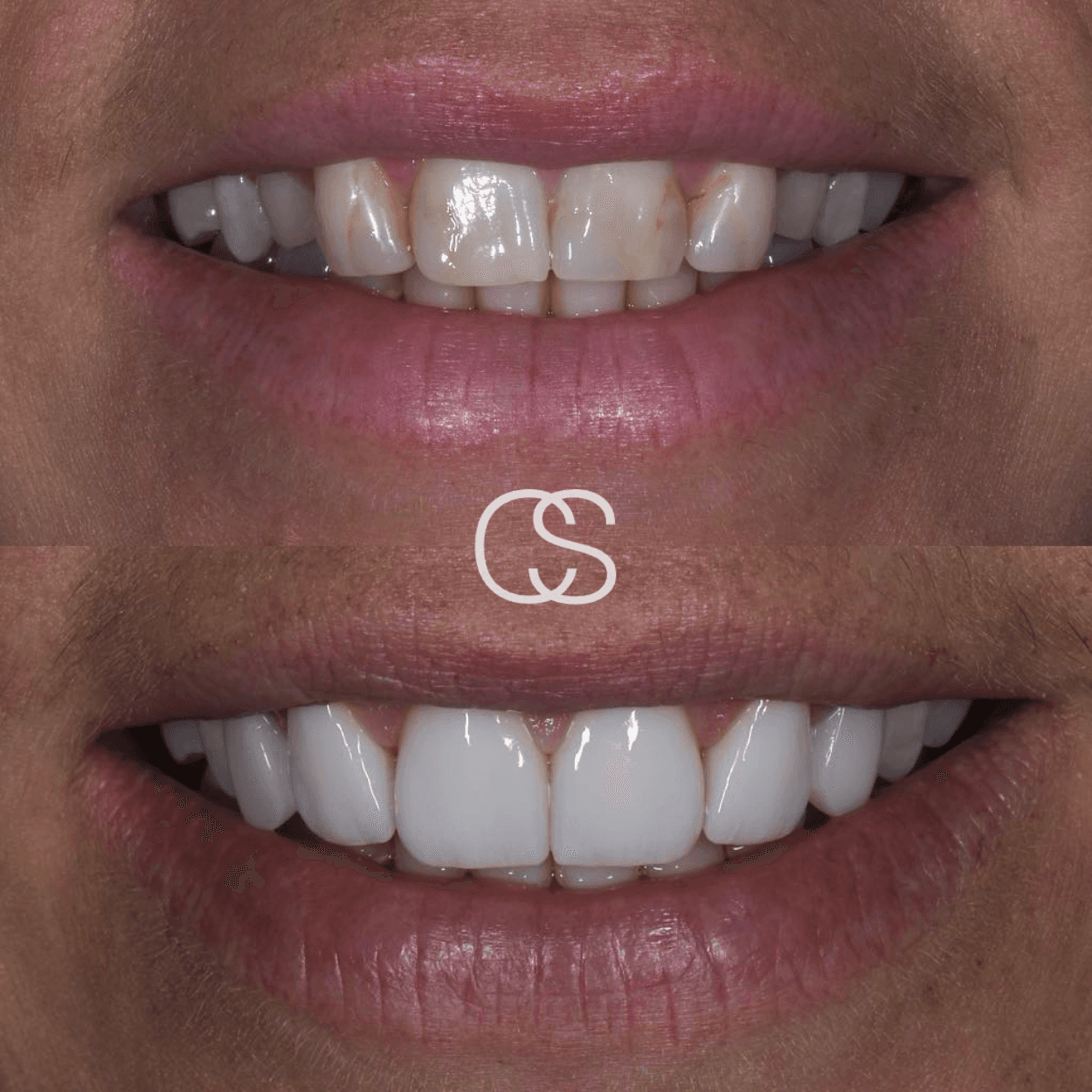 Before & After