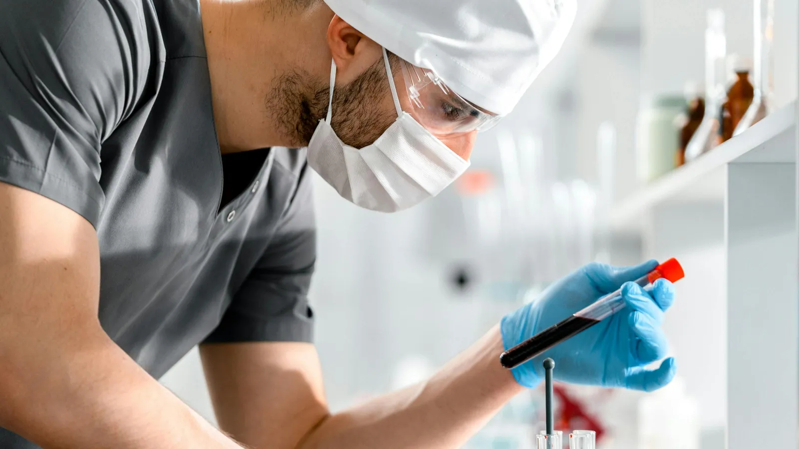 How to Interpret Bilirubin Alongside Other Urine and Blood Markers