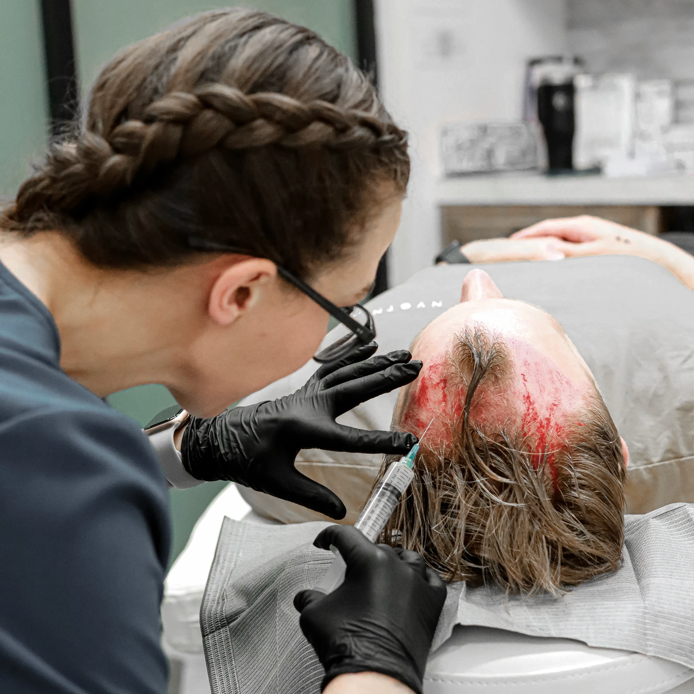 Chelsey Galipeau injecting a male patient's scalp for hair restoration service