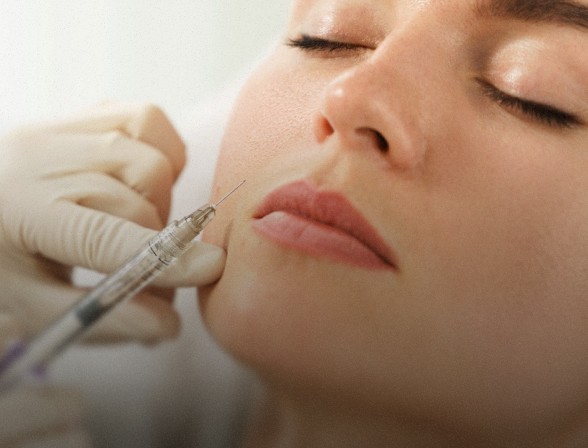 Bioestimuladores de Colágeno