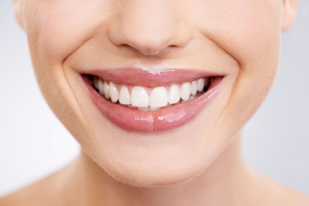 Woman's perfect smile from Hollywood Smile treatment