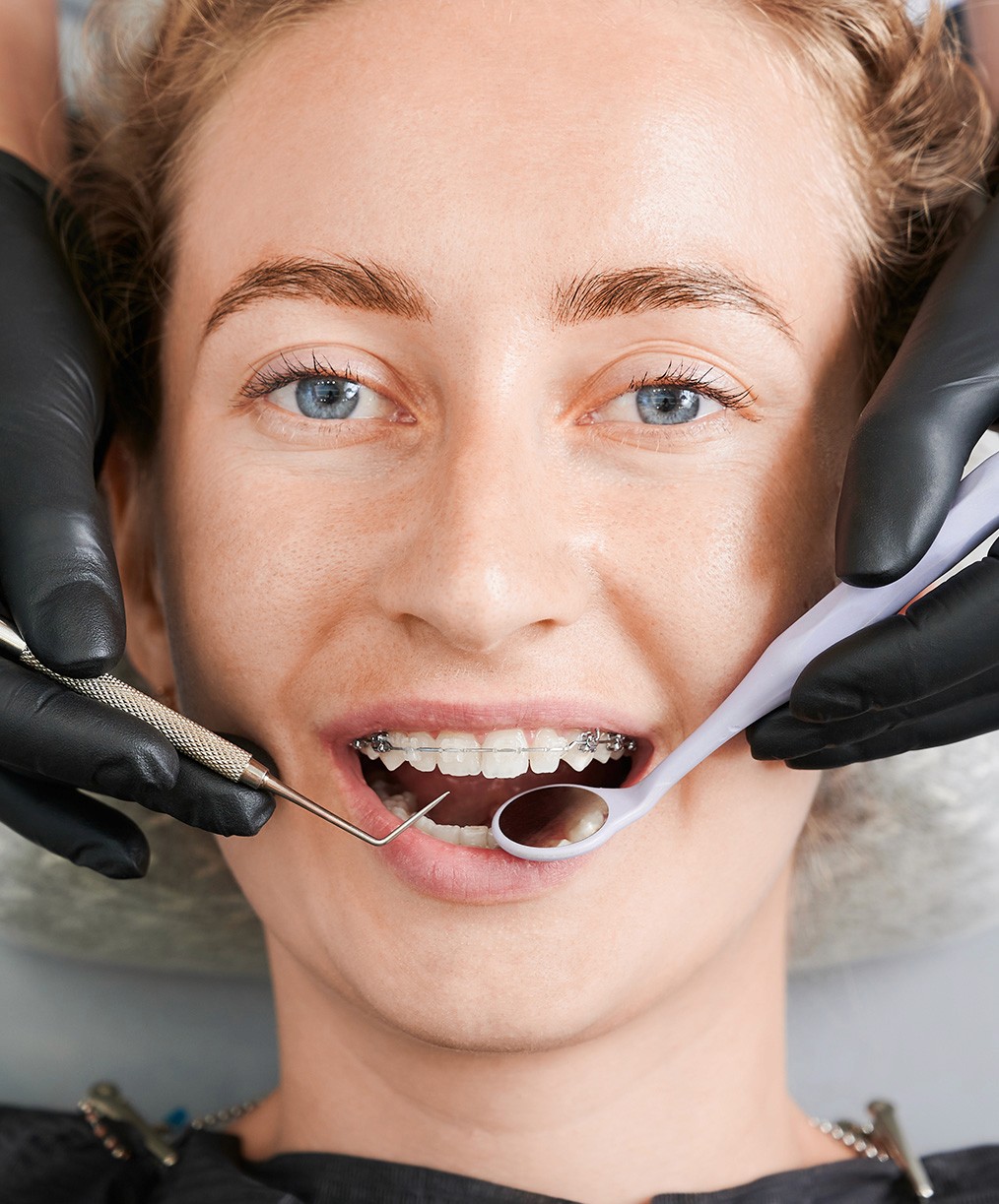 Ortodoncia Especializada