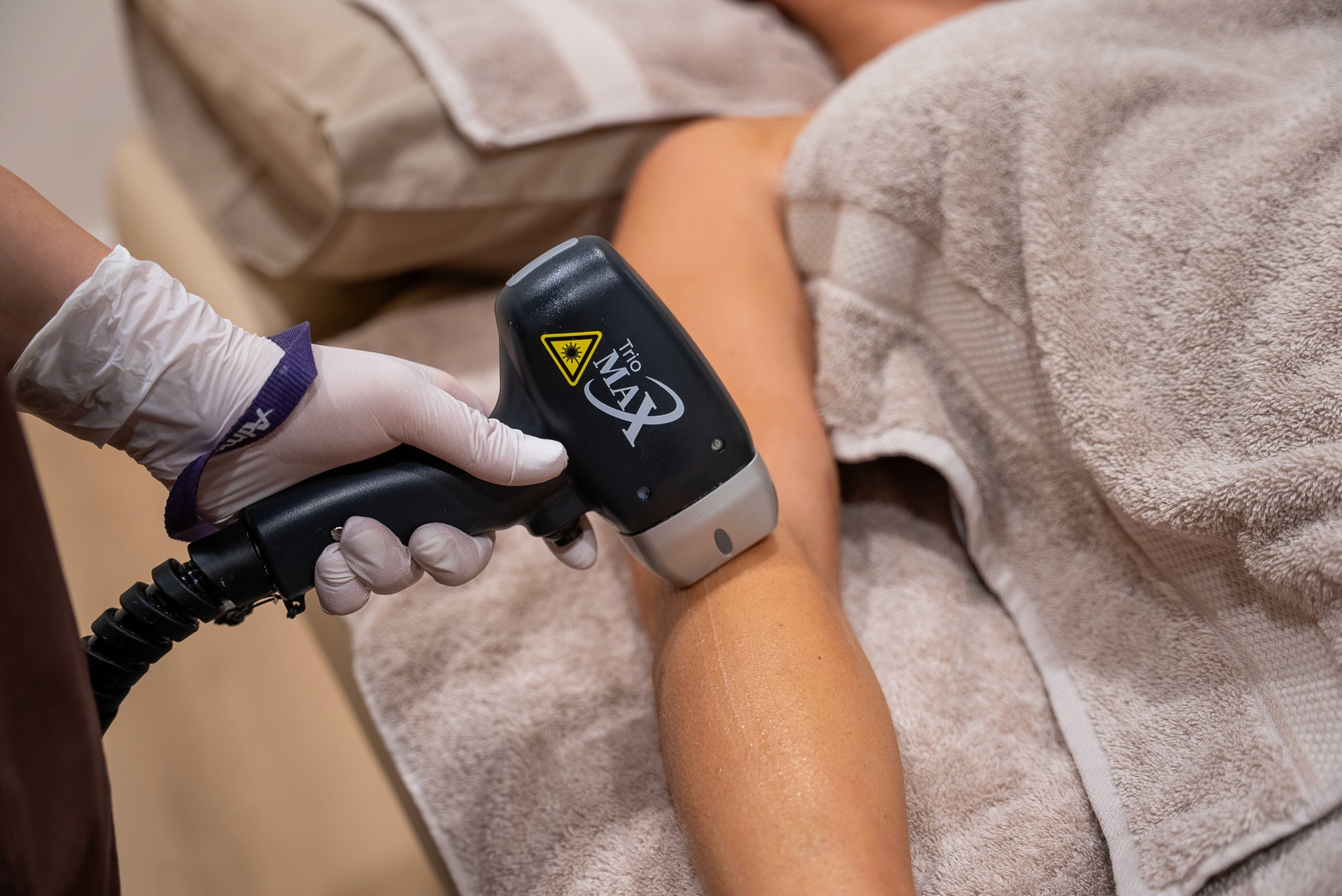 Laser hair removal treatment using Alma Soprano Titanium SE at Aesthetic Skin Co by Lilly.