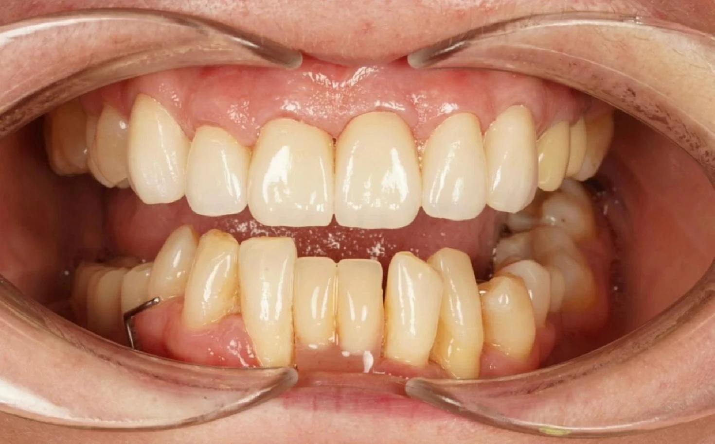 Image before
