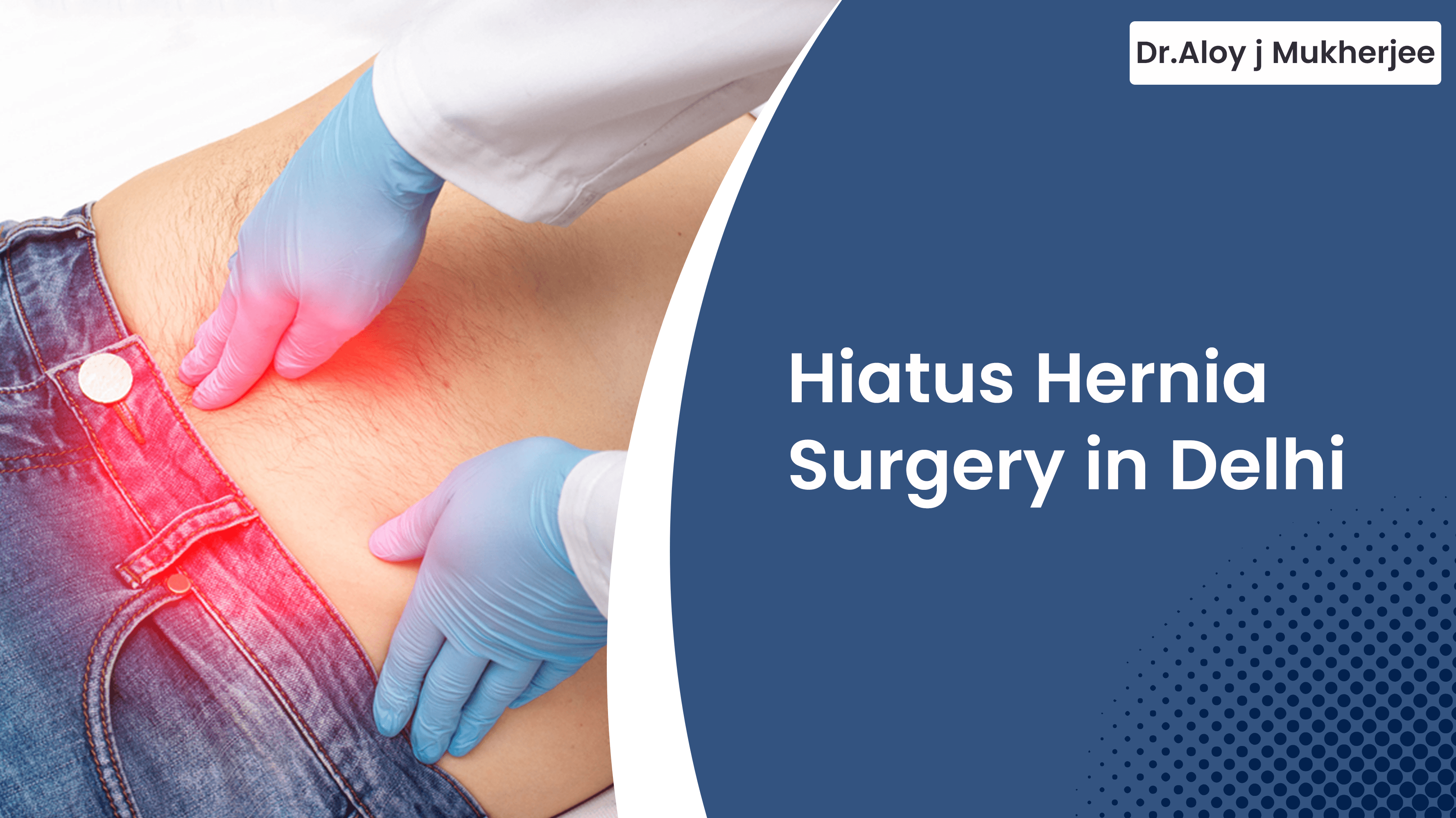 Hiatus Hernia Surgery in Delhi