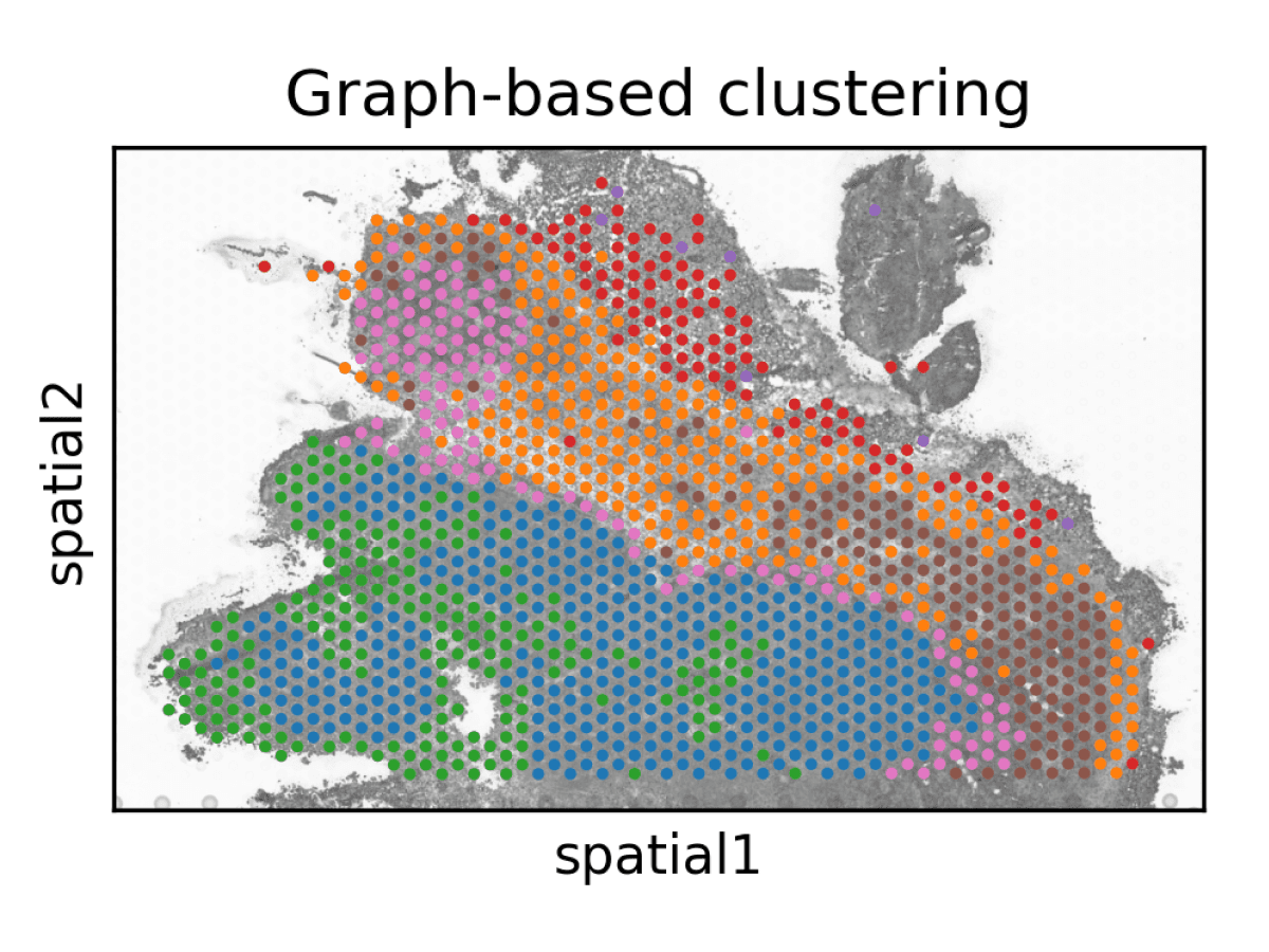 Spatial Feature Plot showcasing Visium Spatial Transcriptomics Visualizations