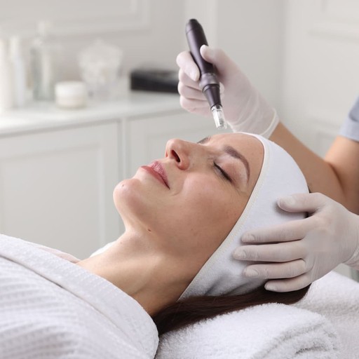 Microneedling treatment at Avinity Health Scottsdale