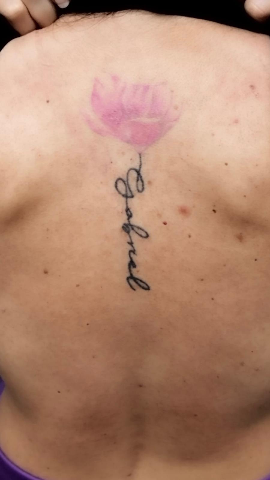 Valoración de tatuaje para eliminación láser en Móstoles